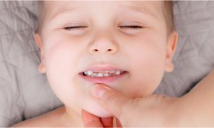 a child with dental cavities in front teeth